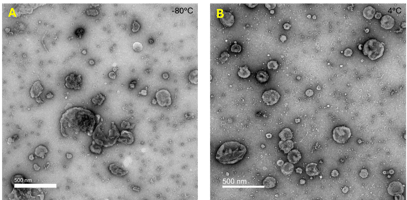 TEM image of two EV samples, one stored frozen at -80°C and the other stored at 4°C.