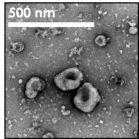 Transmission electron microscopy images of&nbsp; EVs from H1975 cells isolated via size exclusion chromatography.