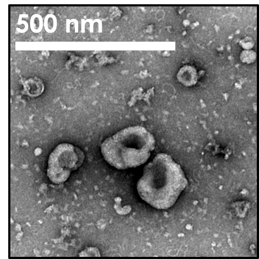 Transmission electron microscopy images of&nbsp; EVs from H1975 cells isolated via size exclusion chromatography.