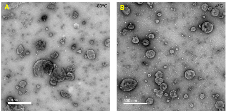 The Microscopic World of EVs - What TEM Can Tell You