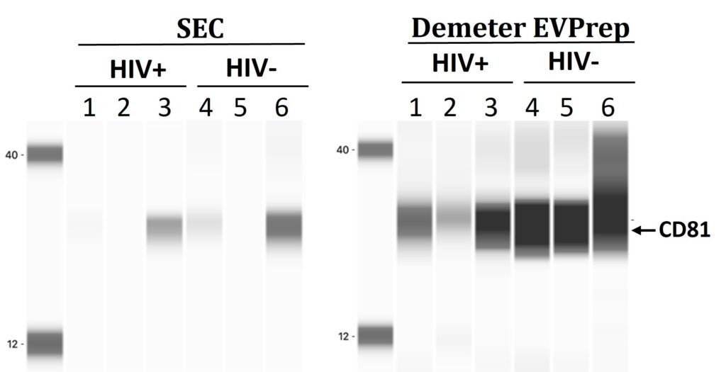 CD81 western blot of EVs from HIV+ and HIV− culture media (lanes 1–6): SEC on the left, Demeter EVPrep on the right, with much stronger CD81 bands for Demeter EVPrep