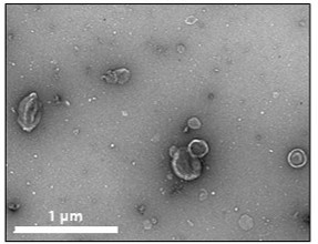 Transmission electron microscopy of intact EVs isolated with Demeter EVPrep